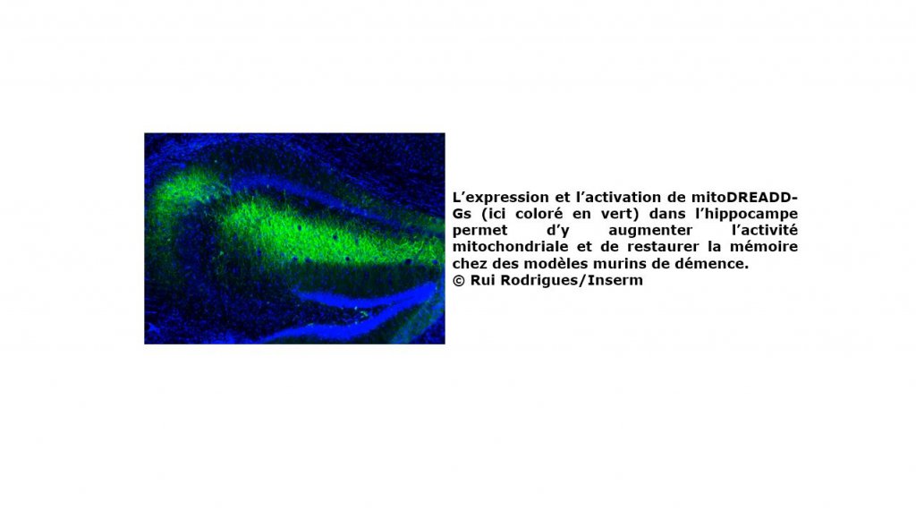 Maladies neurodégénératives : et si la clé se trouvait dans les mitochondries ?