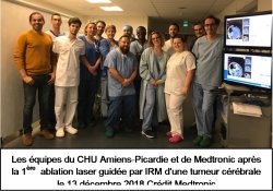 1ères nationale et européenne au  @CHUAmiens ‏ :  Ablations lasers guidées par IRM de tumeurs cérébrales