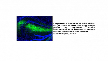 Maladies neurodégénératives : et si la clé se trouvait dans les mitochondries ?