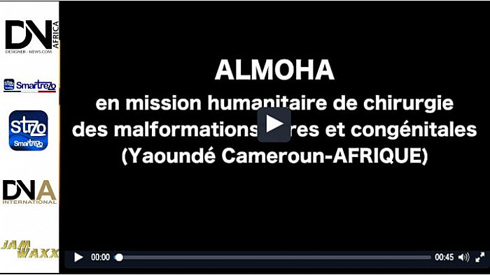 TV Locale Saint-Ouen l'Aumône - ALMOHA Opération chirurgical pédiatrique au Cameroun